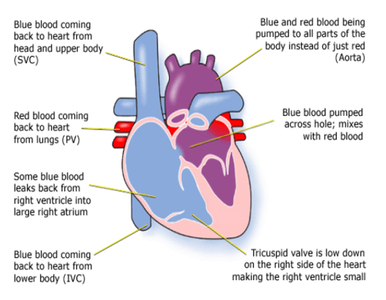 Leaflet Image
