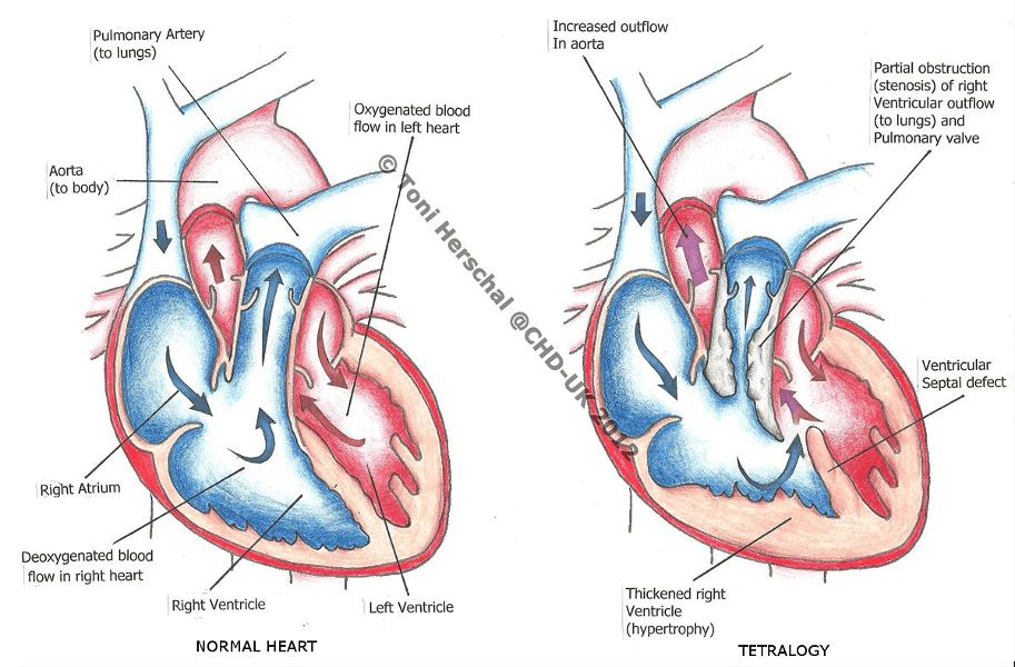 Leaflet Image