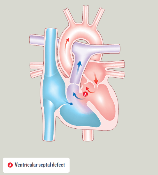 Leaflet Image